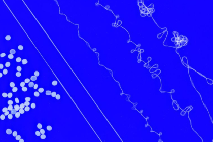 Investigadores del MIT diseñan un hilo elástico que podría transformar el reciclaje de productos textiles