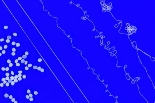 Investigadores del MIT diseñan un hilo elástico que podría transformar el reciclaje de productos textiles